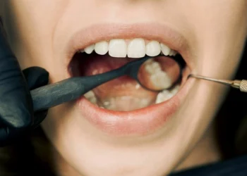 ONG seleciona jovens para tratamento dental gratuito em 148 municípios